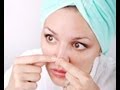 default Natural remedy for blackheads on nose