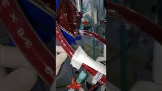 O caminho do Sangue através do ECMO venovenoso: uma breve explanação sobre o circuito