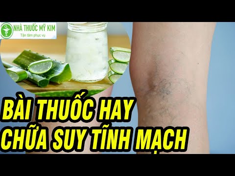 Bài thuốc chữa suy giãn tĩnh mạch hiệu quả tại nhà Các phương pháp điều trị suy tĩnh mạch