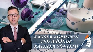 Kanser Ağrısının Tedavisinde Kateter Tedavisi