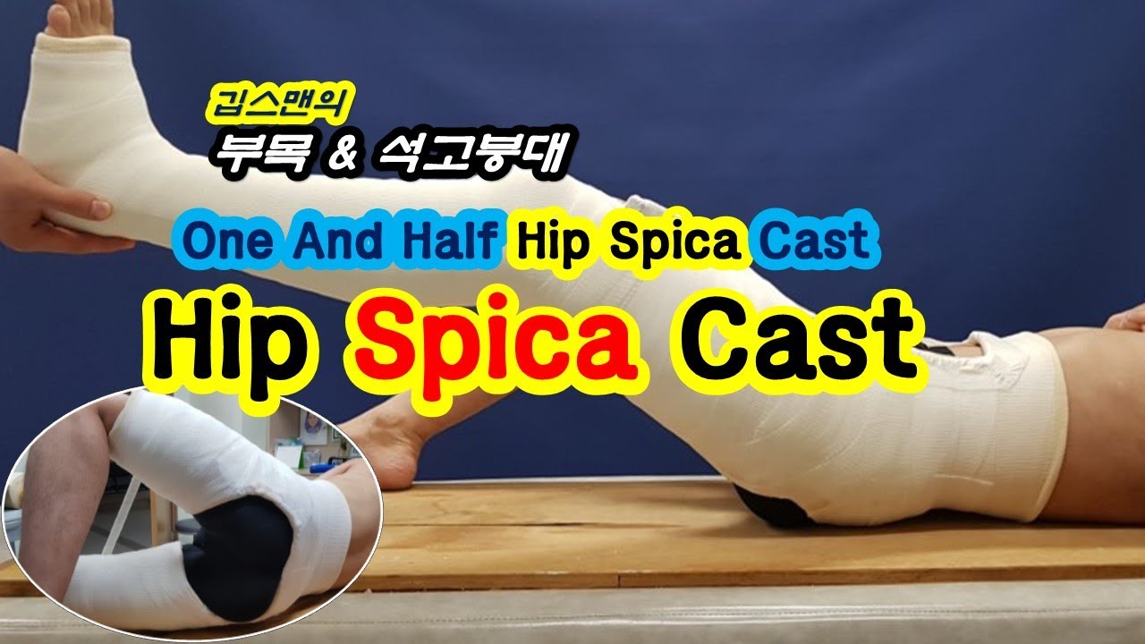 Hip spica cast
