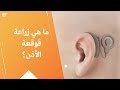 ما هي زراعة قوقعة الأذن؟