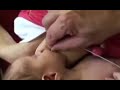 image Tutorial Menyusui Bayi Menthil