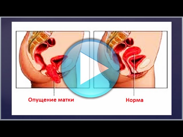 Ответы Доктора Малко (Часто задаваемые вопросы)