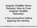 Angular Cheilitis Home Remedy - Safe & Proven Natural Remedy That Works