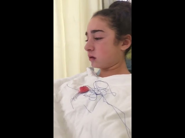 Girl Thinks Her Tongue Fell Out After Getting Wisdom Teeth Removed - Video