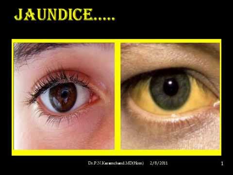 How to Test Liver Function How to Test Liver Function new picture How to Test Liver Function How to Test Liver Function new photo