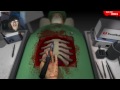 Surgeon Simulator 2013 - 2 HEARTS! SUCCESS (Download)