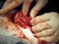 Bladder Stones in Dogs