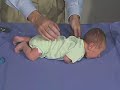 Physical Exam Newborn Normal Positions Prone