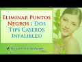 Eliminar Puntos Negros ( Dos Tips Caseros Infalibles)