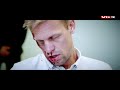 Paradise Deltaker Med Blodig Hevn På Mads Hansen Paradise Deltaker Med Blodig Hevn På Mads Hansen