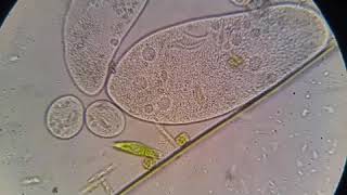 Paramecium - Paramesyum Terliksi Hayvan Hd