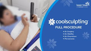 Coolsculpting Procedure A-Z Best Weight Loss Treatment In Bangladesh Laser Treat