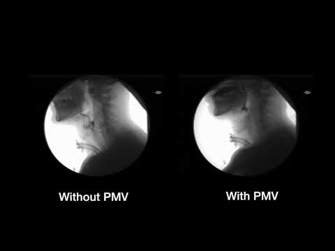 videofluoroscopy