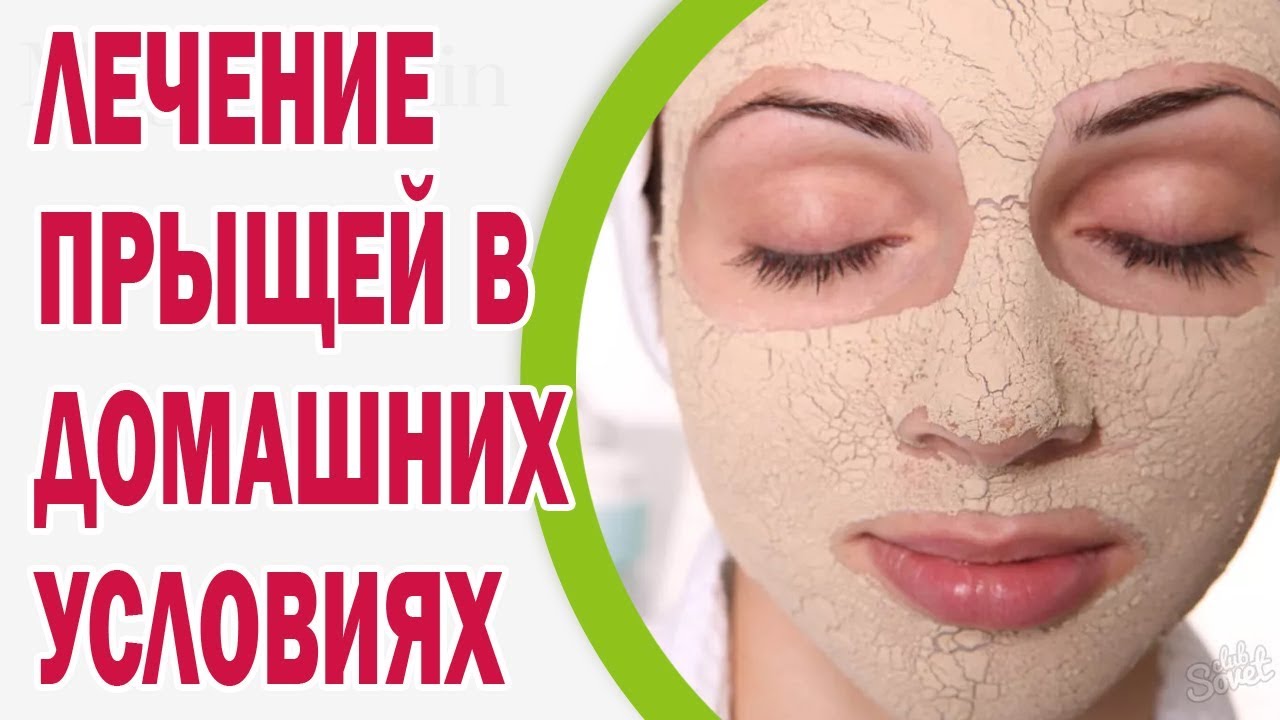 Лечение от прыщей на лице в домашних условиях 243