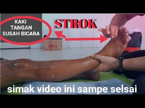 🛑TERAPI STROK PART KE-2 || pijat refleksi