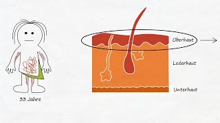 c) Neurodermitis nachvollziehen (Erfahrungsbericht )