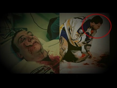 6 САМЫХ СТРАШНЫХ ТРАВМ в ХОККЕЕ 6 САМЫХ СТРАШНЫХ ТРАВМ в ХОККЕЕ