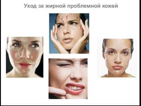 Как ухаживать за проблемной жирной кожи лица Как ухаживать за проблемной жирной кожи лица