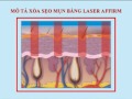 Tham My Vien Bac Si Tu_xoa Seo Ro Bang Laser images Tham My Vien Bac Si Tu_xoa Seo Ro Bang Laser