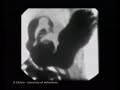Upper Gi Movies Stomach Peristalsis
