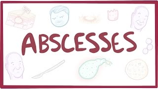 Abscesses - Causes, Symptoms, Diagnosis, Treatment, Pathology
