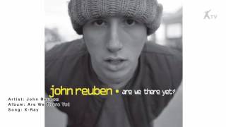 Watch John Reuben Xray video