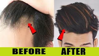 This Remedies Gives You 100% Thick Hair Quickly🔥HINDI ☆ SAYAN