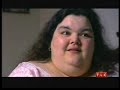 Overweight