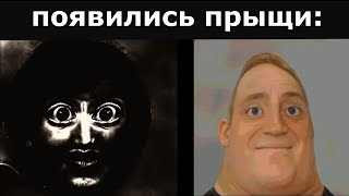 Парни Vs Девушки | Появились Прыщи: