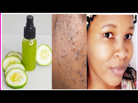 Homemade facial toner for oily skin