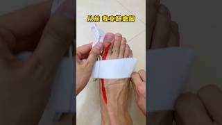 Adjustable Bunion Corrector For Foot Pain Relief