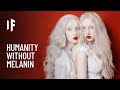 What If Everyone Was Albino?