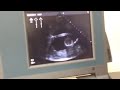 Dara's Ultrasound