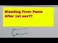 Bleeding From Penis After First Time Sex || How to do sex sex first time || Explained in hindi