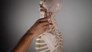 M INTERTRANSVERSO CERVICAL POST