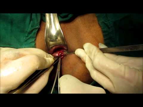 sperm donors toronto teen tied fucked animation