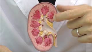 腎結石モデル：動画