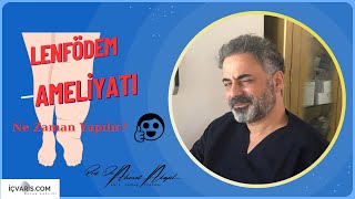 Lenfödem Ameliyatı Hangi Koşullarda Yapılır, Ameliyat Kesin Tedavi Mi? Prof. Dr. Ahmet Akgül
