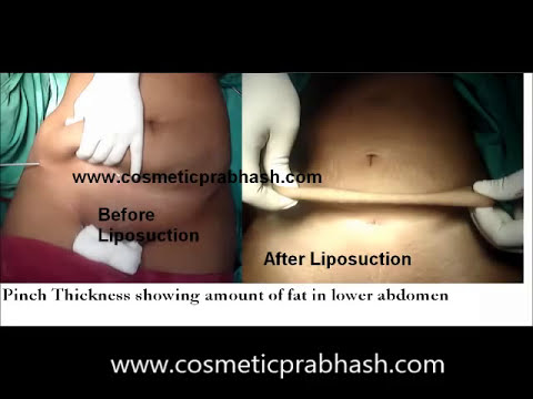 For the growth of penis enlargement