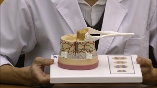 脊髄と脊髄神経根モデル：動画