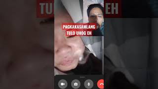 Pagkakasamlang.tulo Uhog Eh..