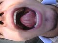 FREAK TALENT: Swallowing my own tongue