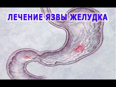Как варить варенье из облепихи: 11 рецептов Городецкая роспись. Уроки. Обсуждение на LiveInternet - Российский