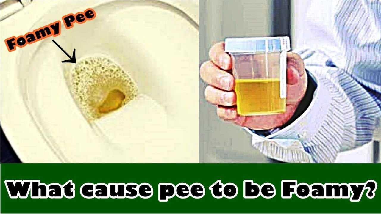 Causes of peeing a lot