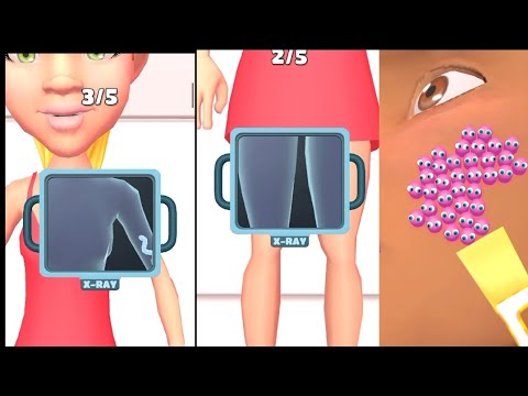 Parasite Cleaner Mobile Games-All Levels Gameplay Parasite Cleaner Mobile Games-All Levels Gameplay