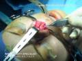 Videos 1 Videos