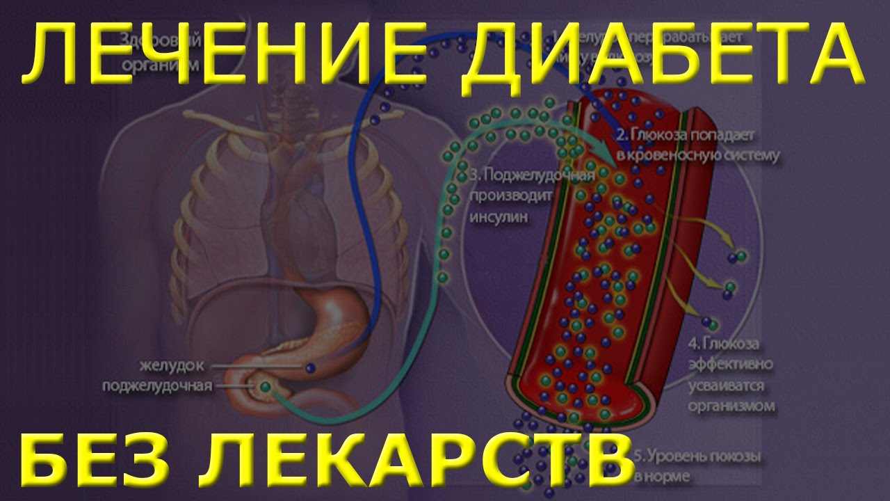 Сахарный диабет как его лечить в домашних условиях Сахарный диабет как его лечить в домашних условиях