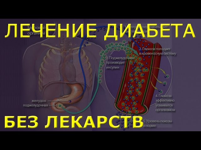 Как вылечить диабет в домашних условиях Как вылечить диабет в домашних условиях
